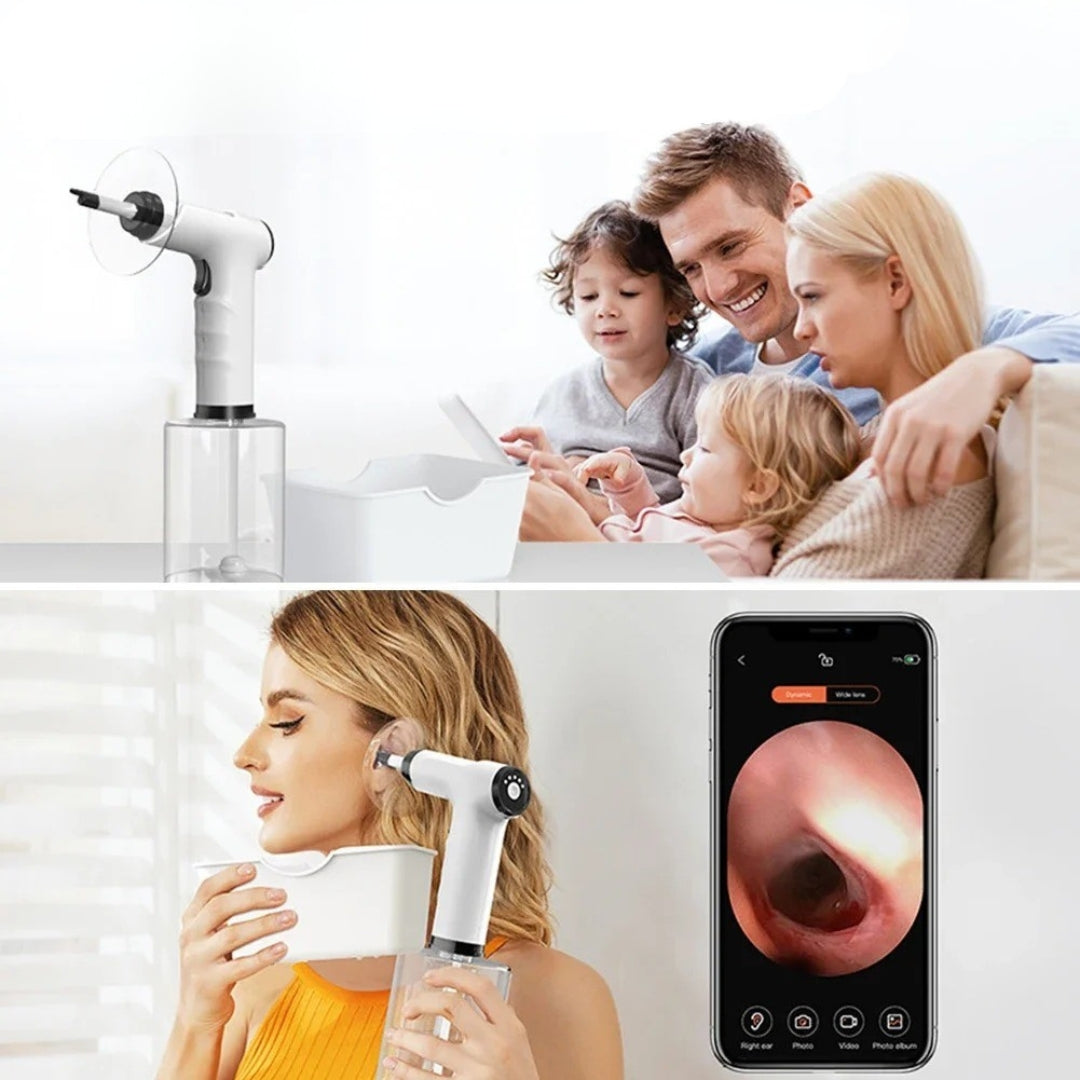 AuriClear™ Ear Wax Remover